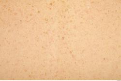 Photo Textures of Human Skin